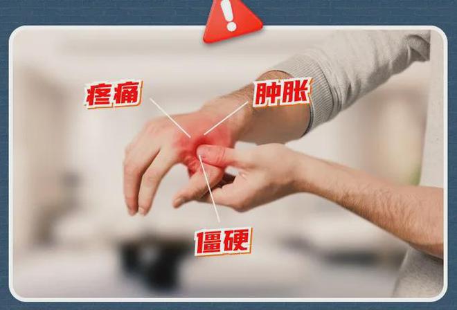 了！手酸、手麻、腱鞘问题推荐用它！新利体育最新版app小米生态杀疯(图13)