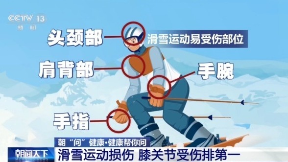 防摔跤 冬季滑雪请收下这份安全指南！新利体育网页版朝“问”健康丨选护具、(图5)